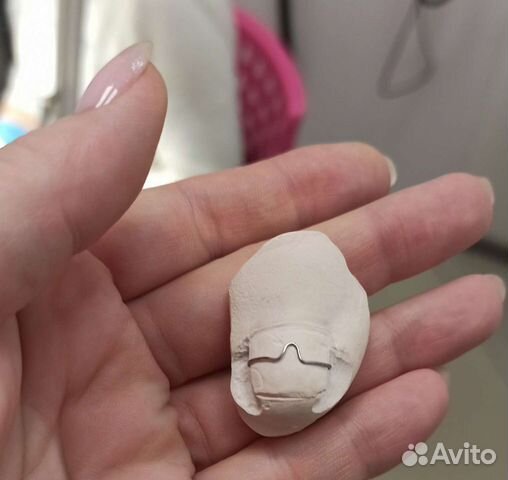 Подолог.Москва.Медицинский педикюр.Вросший ноготь